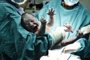 Bebê teve seu pênis quase decepado por médicos