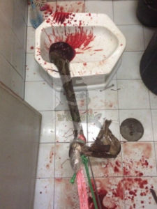 Homem é picado por cobra no pênis ao se sentar em vaso sanitário (Foto: Reprodução