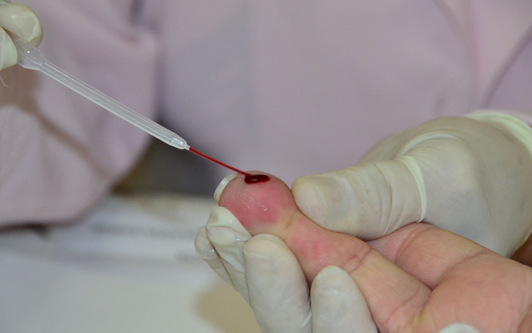 Testes rápidos de sífilis são feitos na rede municipal de João Pessoa (Foto: Ivomar Gomes/Secom-JP)